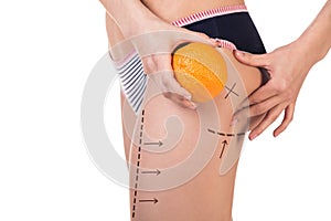 Body with cellulitis and orange fruit photo