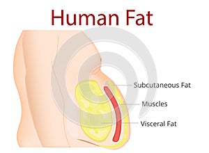 Body Fat, Liposuction, diet , surgery, exercise - Vector Illustration