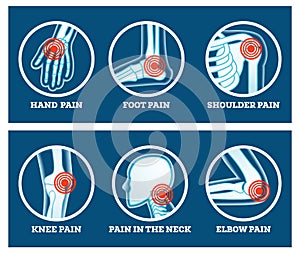 Body Pain. Icons Set. Pain in Hand, Knee, Neck, Elbow, Foot and Shoulder
