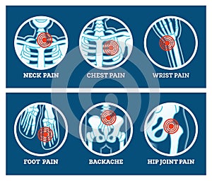 Body Pain. Icons Set. Pain in Neck, Chest, Foot, Backache, Hip Joint and Wrist