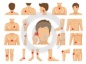 Body pain. Physical injury human trauma symbols on legs shoulders hands pain dots vector set