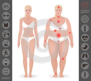 Body of a woman, thick and thin , pain points, detailed vector i