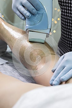 Bodycare Ideas. Macro Close-up Image of Female Legs Being Treated by Professional Beautician with Sugaring Wax Depilation Device