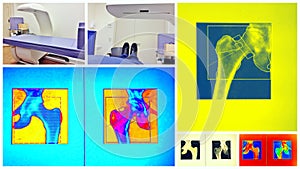 Bone density scan colorful collage