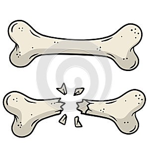 Bone fracture. Trauma to the body. Crack and splinters. Dangerous situation and wound