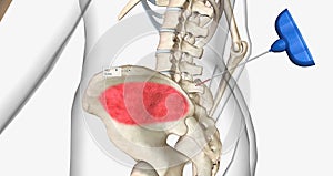 Bone Marrow Biopsy, External view