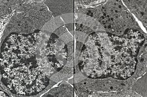 Bone marrow. Erythroid and myeloid series