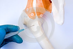 Bone marrow examination procedure: biopsy, aspiration or paracentesis concept photo. Doctor holds in hand dressed in glove syringe