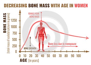 Bone mass decreasing photo