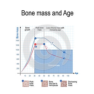 Bone mass for male and female. Age and osteoporosis. Chart