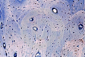 Bone. Osteons and interstitial lamellae