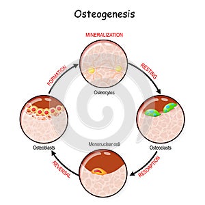 Bone remodeling. Describe a process of Ossification photo