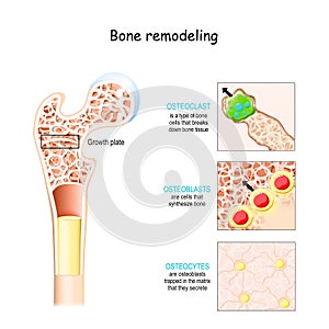 Bone remodeling process. Osteoblast, osteoclast, and osteocyte photo