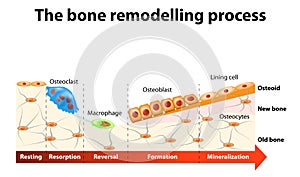 Bone remodelling process photo