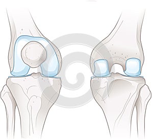Bones of the knee joint. 3D Illustration photo