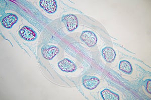 Botanical study of Selaginella strobilus under microscopic view