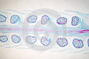 Botanical study of Selaginella strobilus under microscopic view