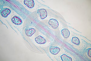 Botanical study of Selaginella strobilus under microscopic view photo