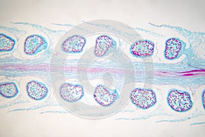 Botanical study of Selaginella strobilus under microscopic view photo