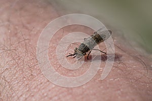 Botfly stands in human skin