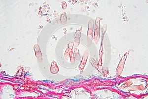 Botrytis allii under the microscope