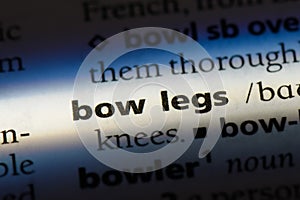 bowlegs