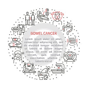 Bowel cancer illustration