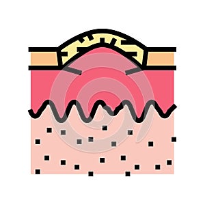 boxcar acne scar color icon vector illustration