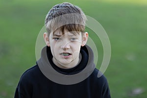 A boy with braces and a black hoodie is looking at the camera