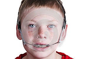 Boy with braces and headgear photo