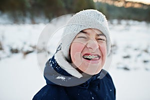 Boy with braces show funny face in winter nature. Outdoors in snow