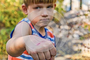 A boy with a broken fist looks menacingly and hits the camera