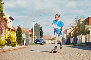 Boy with broken hand