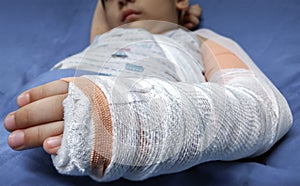 Boy with a Cast on a Broken Forearm.