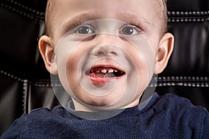 Boy cavities Caused a lot like eating candy. Dental medicine and healthcare
