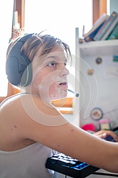 Boy with chickenpox playing video games