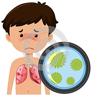 Boy with coronavirus in his lungs