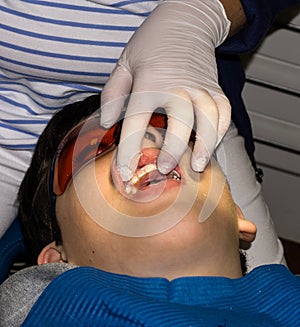 Boy in dental treatment. brace. health care