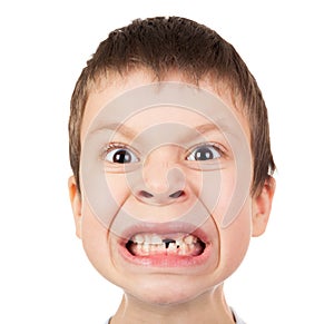 Boy face closeup with a lost tooth