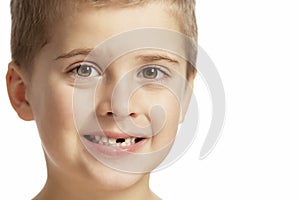 A boy without a front tooth smiles. Close-up. Isolated over white background
