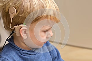 Boy With A Hearing Aids And Cochlear Implants photo