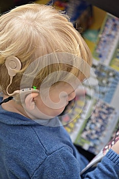 Boy With A Hearing Aids And Cochlear Implants