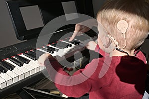 A Boy With A Hearing Aids And Cochlear Implants Playing photo