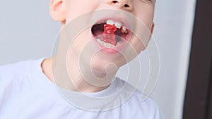 Boy, kid holds in his mouth and eats gelatinous sweets, gummy bear, concept of children`s delicacy, healthy and unhealthy food,