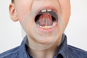 Boy, kid opened his mouth, oral cavity, close-up teeth, performs articulation exercises for the tongue, vocals, dental concept,