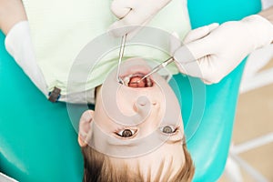 Boy with mouth opened during oral inspection in dental clinic