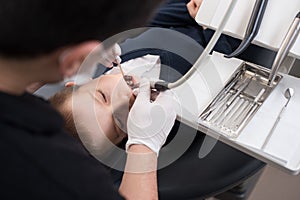 Boy with open mouth during drilling treatment at the pediatric dentist in dental clinic