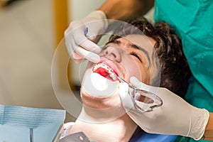 Boy and orthodontist inserting blue ligatures