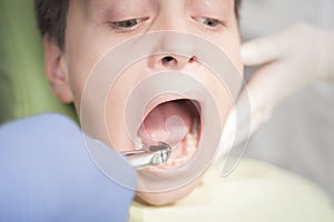 Boy with perfect teeth scared at the dentist