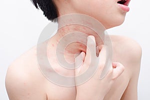 Boy scratching his skin over white photo